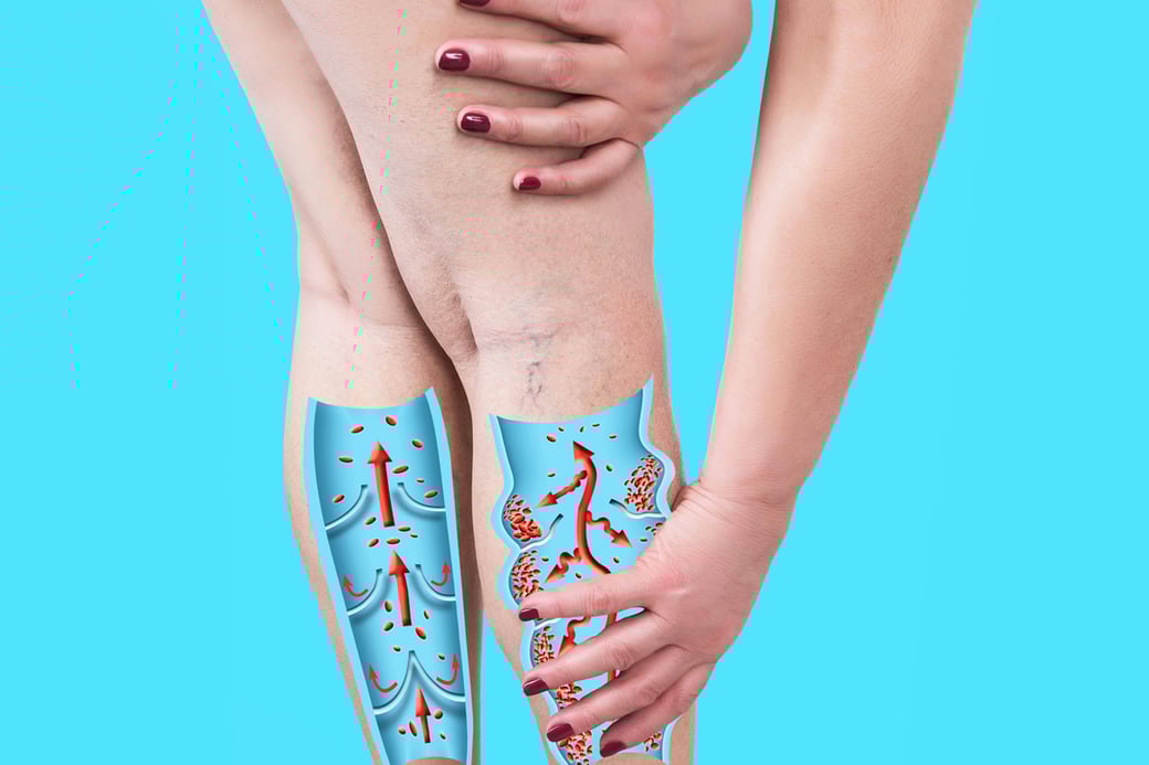 SO_iStock-1202683662_AM-2